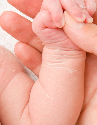 Dry Patches on Baby Skin: Causes & Simple Remedies